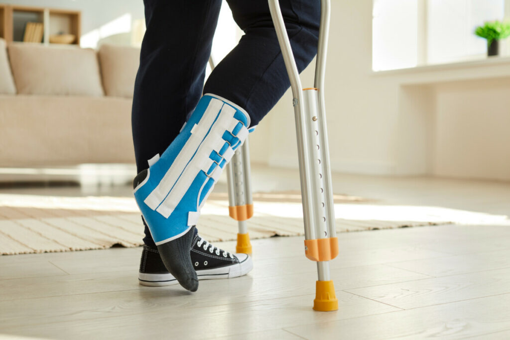 Close up of crutches and bandage on leg of man who has fracture of ankle or foot, broken bone